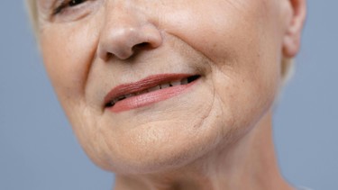 Lão hóa da và các biện pháp quan trọng phòng ngừa lão hoá sớm