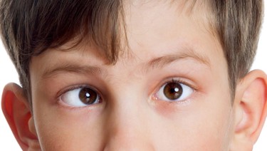 Lé kim là gì? Cách nhận biết và cải thiện mắt lé kim hiệu quả