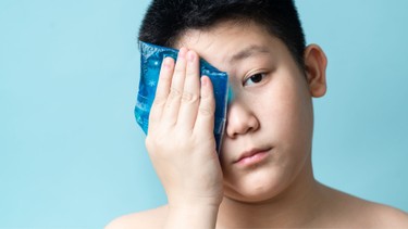 Lẹo mắt vỡ mủ có nguy hiểm không? Cách chăm sóc để tránh biến chứng