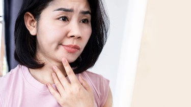Liệt dây thần kinh số 7: Hiểu đúng để chữa trị kịp thời