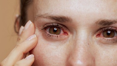 Đau mắt hột có tự khỏi không? Những điều cần biết để bảo vệ thị lực kịp thời