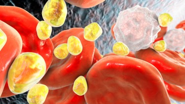 Lipid máu là gì? Hiểu đúng để bảo vệ tim mạch và sức khỏe toàn thân