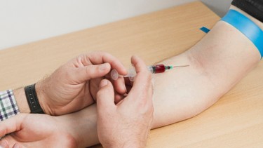 Lưu ý sau khi tiêm huyết tương giàu tiểu cầu có thể bạn chưa biết