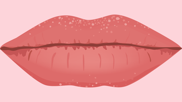 Mách bạn cách chữa nổi hạt Fordyce trên môi​ cực hiệu quả