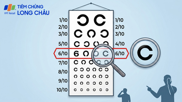 Mắt 6/10 là cận bao nhiêu độ? Cách hiểu đúng để bảo vệ thị lực