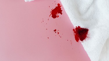 Máu sảy thai: Dấu hiệu nhận biết và cách xử lý kịp thời để bảo vệ thai nhi