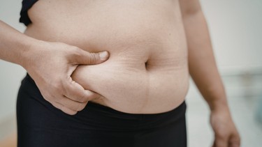 Mỡ bụng: Nguyên nhân hình thành và cách giảm hiệu quả