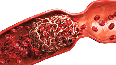 Mỡ máu cao bao nhiêu thì phải uống thuốc?