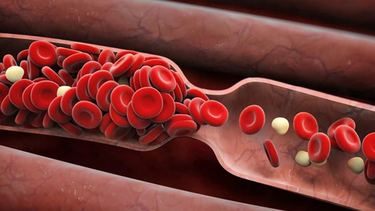 Mỡ máu là gì? Chỉ số mỡ máu bao nhiêu là bình thường?