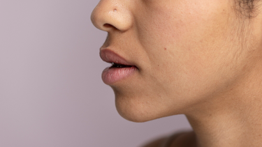 Môi thâm là bệnh gì? Nguyên nhân, triệu chứng và khi nào cần đi khám