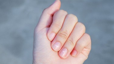 Móng tay trẻ có đốm trắng: Nguyên nhân và cách xử lý an toàn