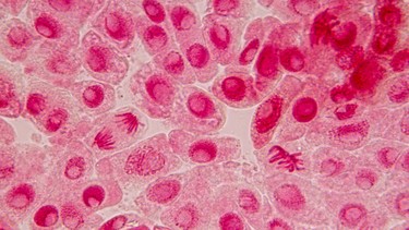 Myoglobin là gì? Xét nghiệm myoglobin và ý nghĩa lâm sàng