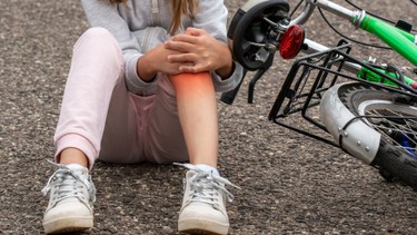 Ngã xe bị bầm tím: Cách xử lý đúng để hồi phục