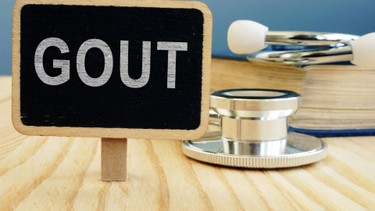 Người bị bệnh gút có ăn được thịt vịt không? Hướng dẫn ăn thịt vịt cho người bệnh gút