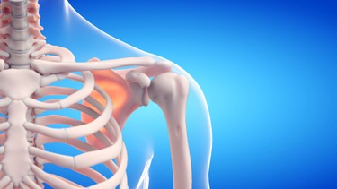 Nguyên nhân của bệnh loãng xương và cách phòng ngừa
