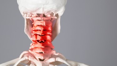 Nguyên nhân gây gai cột sống cổ và những điều bạn cần biết