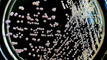 Nhiễm nấm candida ở nam giới: Dấu hiệu nhận biết và cách phòng ngừa