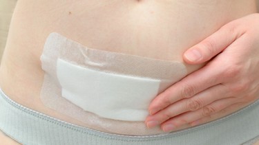 Nhiễm trùng vết mổ sau sinh: Dấu hiệu nhận biết, nguyên nhân và cách điều trị