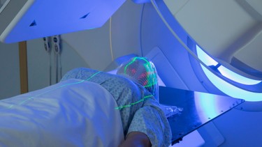 Những biến chứng sau xạ trị thường gặp và hướng dẫn kiểm soát an toàn