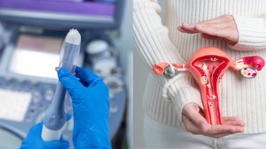 Những thông tin cơ bản xoay quanh phương pháp siêu âm canh trứng