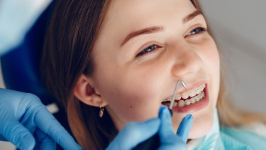 Niềng răng có đau không? Cách giảm đau khi niềng răng