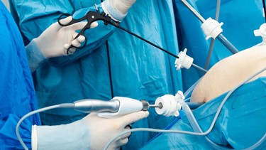 Nội soi ổ bụng là gì? Khi nào cần thực hiện và những điều cần biết