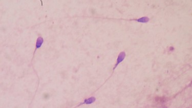 Nuốt tinh trùng có bị HIV không? Cách phòng ngừa HIV