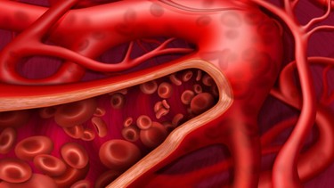 Phân độ thiếu máu là gì? Dấu hiệu và nguyên nhân thiếu máu theo phân độ