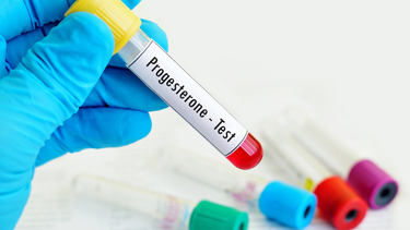 Progesterone là gì? Vai trò của hormone progesterone với cơ thể