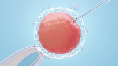 Quá trình làm IVF mất bao lâu? Tìm hiểu các giai đoạn thực hiện