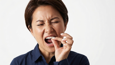 Răng vĩnh viễn bị lung lay thì phải làm sao?