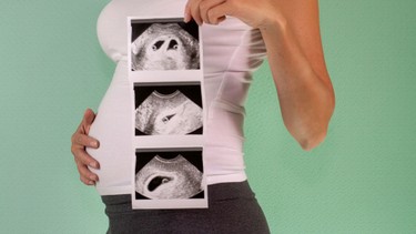 Rỉ ối 3 tháng đầu: Dấu hiệu, nguyên nhân và cách xử lý