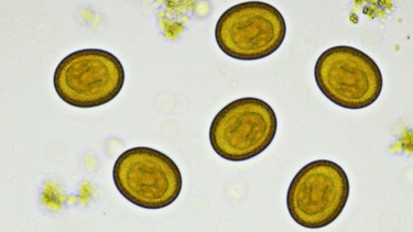 Sán chó có trị được không? Thời gian điều trị sán chó kéo dài bao lâu?