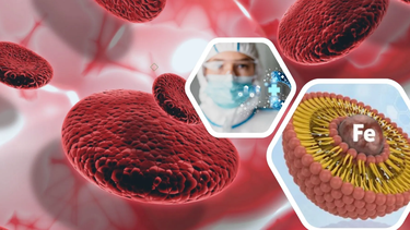 Sắt Liposome là gì? Cơ chế hoạt động của sắt Liposome