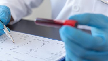 SCC là xét nghiệm gì​? Khi nào cần thực hiện?