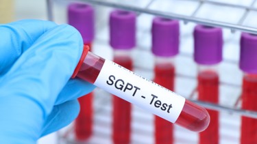 SGPT trong xét nghiệm máu là gì? Chỉ số này có liên quan đến sức khỏe gan không?