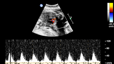 Siêu âm tim thai ở tuần thứ mấy? Những điều mẹ bầu cần biết