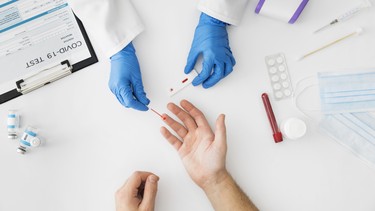 Sốt mấy ngày thì xét nghiệm sốt xuất huyết sẽ ra bệnh?