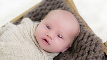 Sứt môi nhẹ là gì? Triệu chứng nhận biết và phương pháp chữa trị