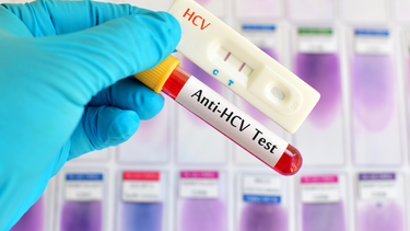 Xét nghiệm HCV Ab miễn dịch tự động: Ý nghĩa, tầm quan trọng trong sàng lọc viêm gan C