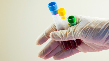 Tăng bạch cầu đơn nhân nhiễm khuẩn: Nguyên nhân và cách điều trị