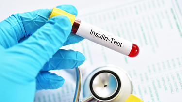 Tăng insulin máu: Nguyên nhân, triệu chứng và cách kiểm soát hiệu quả