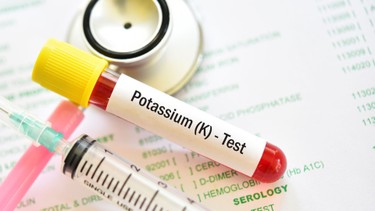 Tăng kali máu: Nguyên nhân, dấu hiệu nhận biết và hướng xử trí