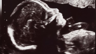 Thai 31 tuần nặng bao nhiêu? Cân nặng chuẩn và những lưu ý mẹ cần biết