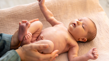 Thoát vị rốn ở trẻ sơ sinh: Dấu hiệu, nguyên nhân và cách xử lý