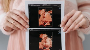 Thời điểm nào siêu âm 4D là tốt nhất? 3 mốc thời điểm mẹ bầu cần nắm