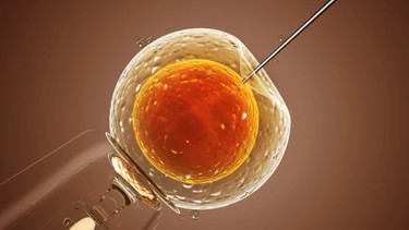 Thụ tinh nhân tạo là gì? Các phương pháp thụ tinh nhân tạo