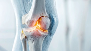 Nhóm những thực phẩm tốt cho xương khớp: Top lựa chọn và cách ăn đúng chuẩn