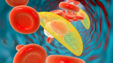 Toxoplasmosis là gì? Triệu chứng nhận biết và đối tượng có nguy cơ cao mắc bệnh