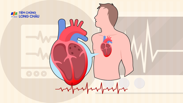 Tràn dịch màng tim là gì? Nguyên nhân, triệu chứng và phương pháp điều trị